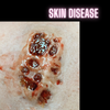 Skin Disease Wound 1