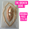 Discounted / Reject Prosthetics