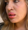 The Botched Lip Filler
