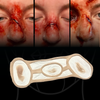 The Broken Nose (Set of 3)
