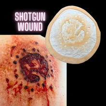  Shotgun Wound 1
