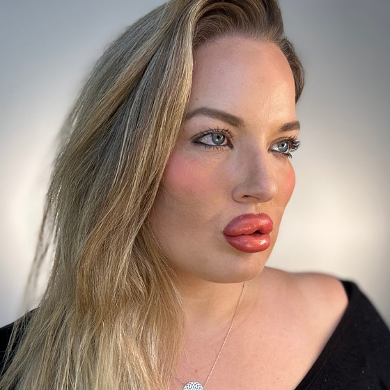 Woman with blonde hair and black top against a plain background plastic surgery lip filler cheek filler