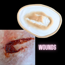  Skin Wound 5