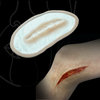 Skin Wound 8