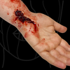 Skin Wound 3
