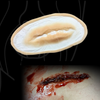 Skin Wound 10