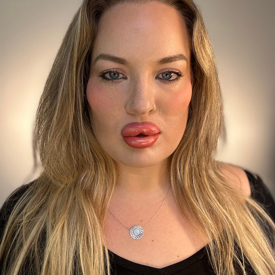 Woman with long blonde hair wearing a black top and necklace against a neutral background plastic surgery lip filler cheek filler