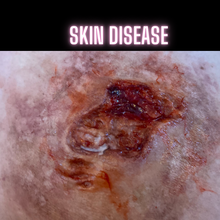  The Skin Disease Wound 2