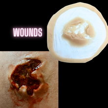  Skin Wound 4
