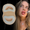 The Botched Lip Filler