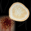 Shotgun Wound 2
