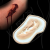 Skin Wound 9