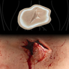 The Explosive Exit Wound