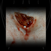 Skin Wound 1