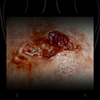 The Skin Disease Wound 2