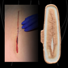The Open Surgery Slice
