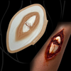 The Broken Bone