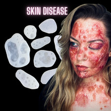  Skin Hives Bondo Moulds (x7)