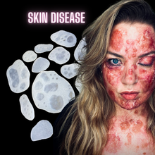  Skin Hives Bondo Moulds (Full Set x14)