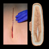 The Open Surgery Slice